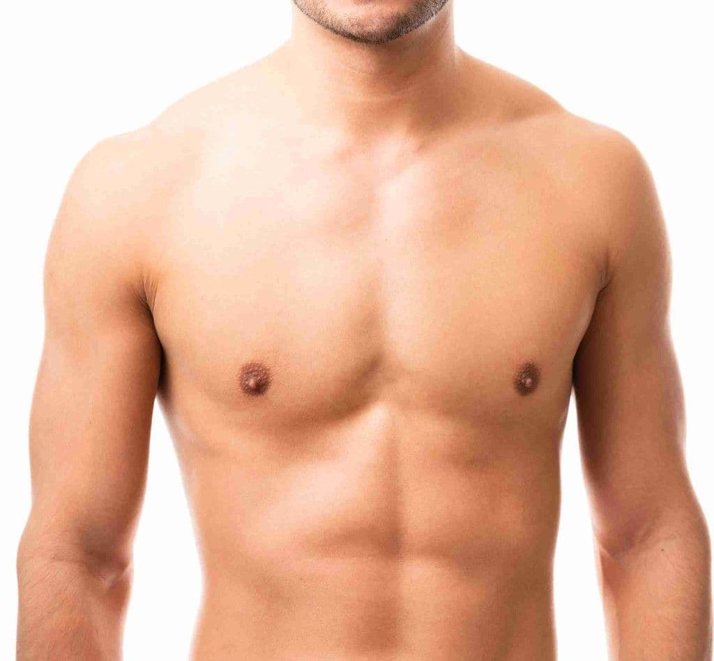 Gynecomastia