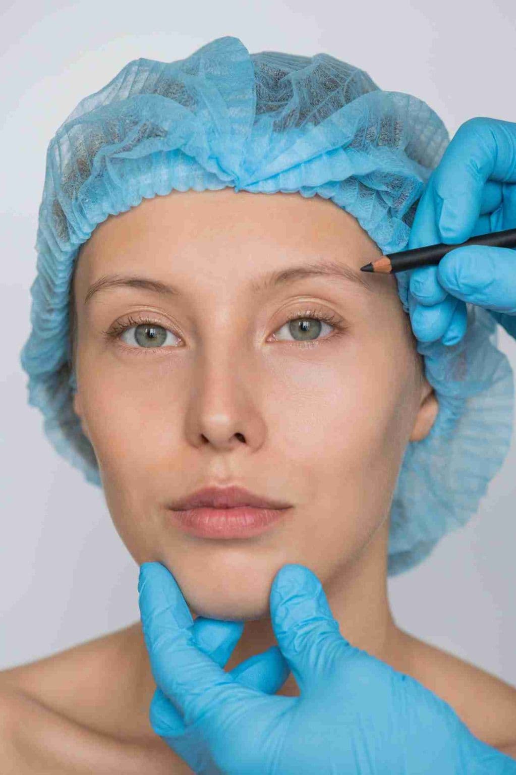 Brow Lift