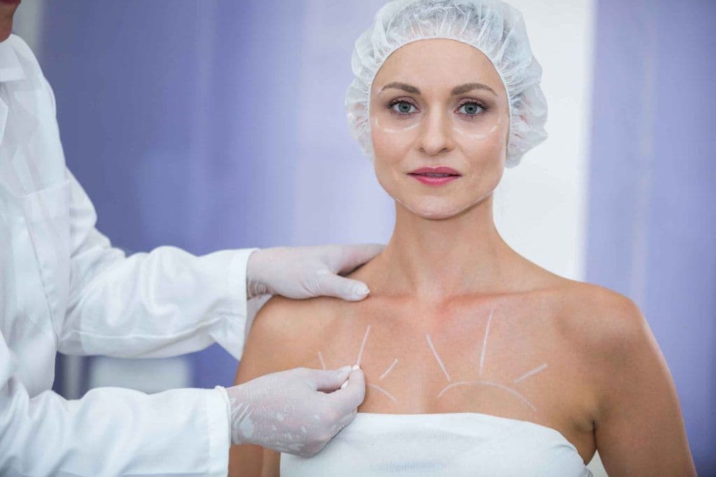 Breast Lift (Mastopexy)